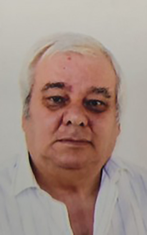 ORTIGO BENAZZI DI ANNI 87